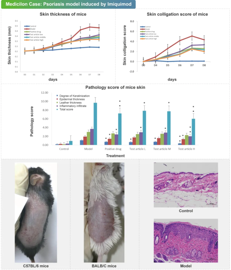 咪喹莫特诱导的背部皮肤银屑病模型案例.webp